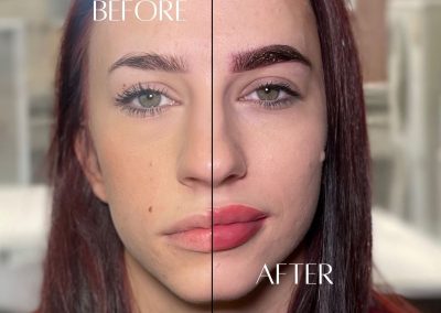 Before after Azra